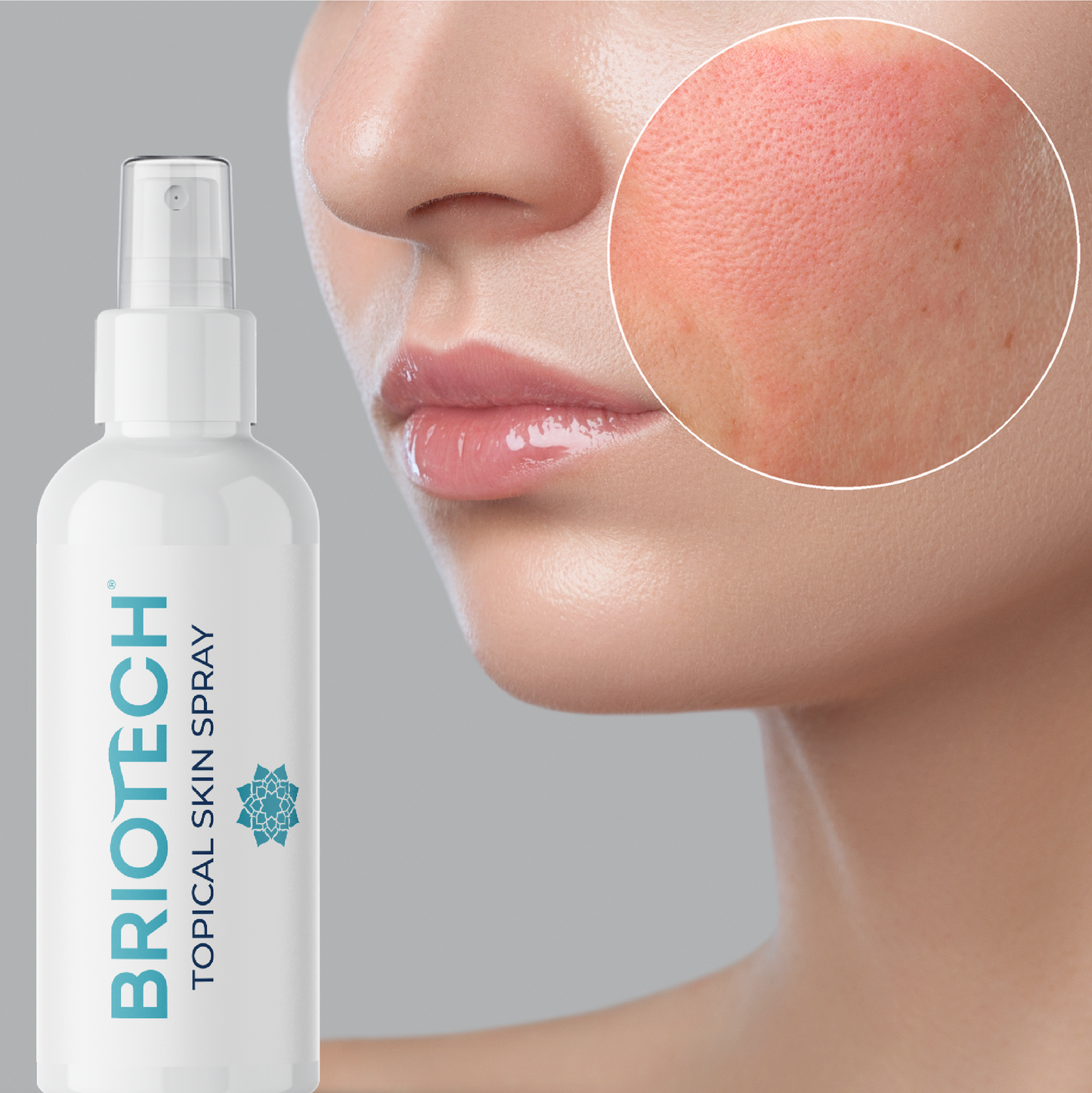 Briotech Topical Skin Spray