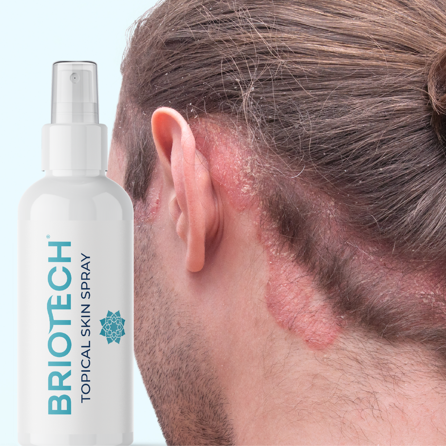 Briotech Topical Skin Spray